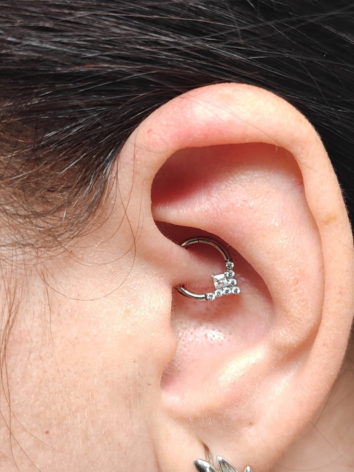 Migrén piercing – akupunktúrás piercing titánium ékszerrel