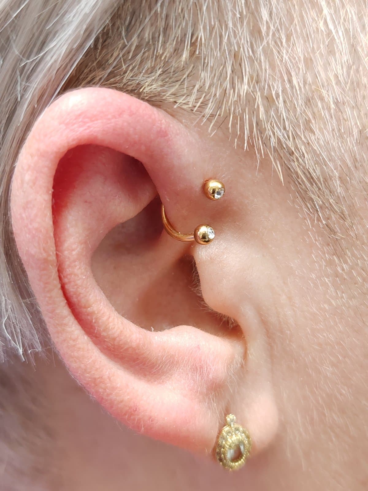 Változókori piercing – akupunktúrás piercing titánium ékszerrel